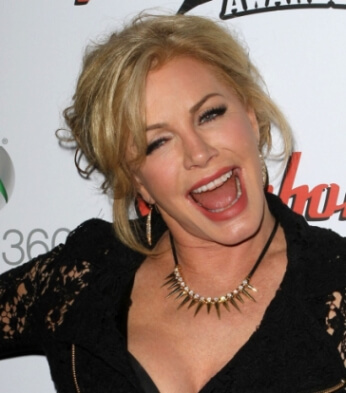 Shannon Tweed plastic surgery pictures