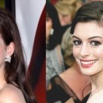 Anne Hathaway plastic surgery before after 150x150