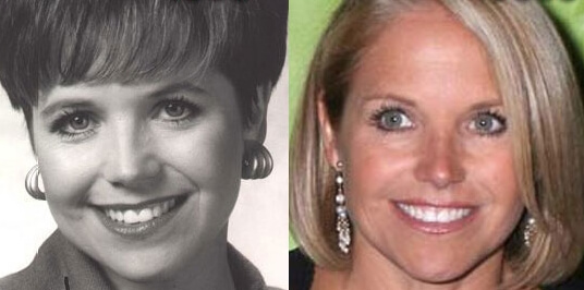 Katie Couric before and after plastic surgery