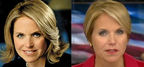 Katie Couric plastic surgery before and after