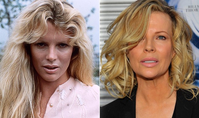 Kim Basinger before and after cosmetic procedures