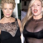 Kim Basinger removed breast implants 150x150