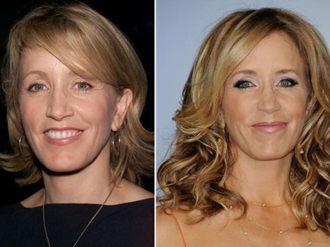 Felicity Huffman before and after