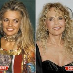 Dyan Cannon before and after 150x150