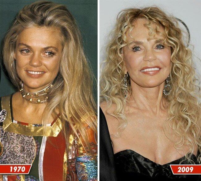 Dyan Cannon before and after
