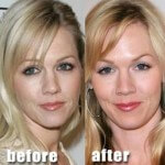 Jennie Garth before and after 150x150