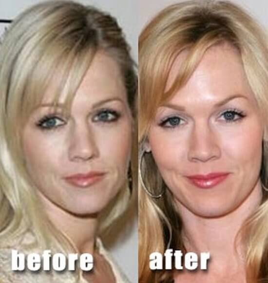Jennie Garth before and after