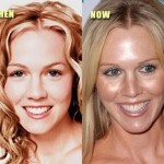 Jennie Garth plastic surgery before and after 150x150