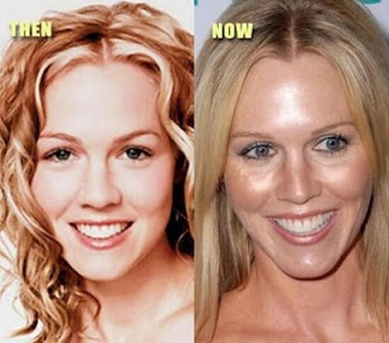 Jennie Garth plastic surgery before and after
