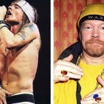Axl Rose plastic surgery before and after 150x150