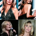 Olivia Newton John before and after plastic surgery 150x150