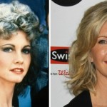 Olivia Newton John before and after plastic surgery facelift 150x150