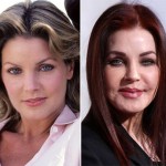 Priscilla Presley plastic surgery before and after 150x150