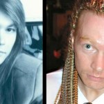 axl rose before and after plastic surgery 150x150