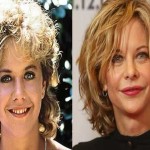 Meg Ryan before and after plastic surgery 150x150