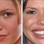 Nikki Cox face before and after plastic surgery 150x150