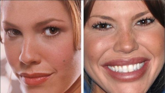 Nikki Cox face before and after plastic surgery