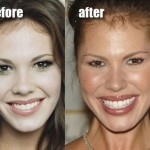 Nikki Cox facelift before and after 150x150