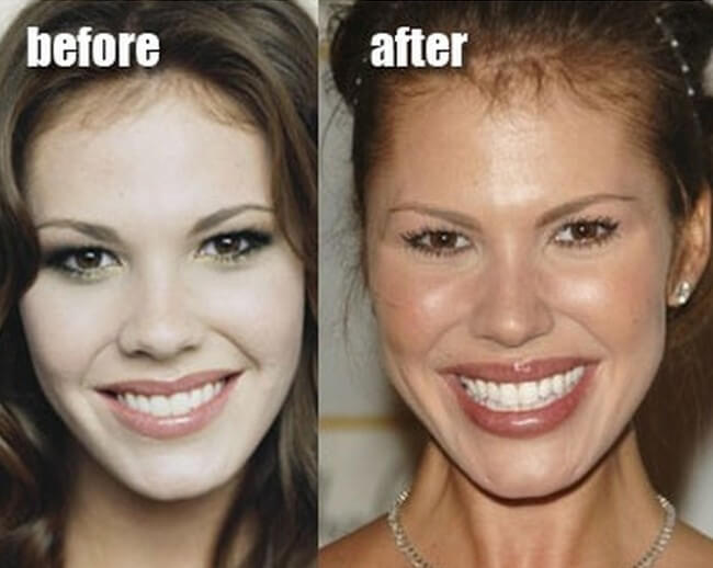 Nikki Cox facelift before and after