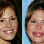 Nikki Cox plastic surgery before and after 150x150