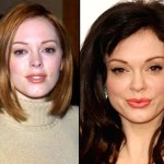 Rose McGowan before and after facelift 150x150