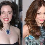 Rose McGowan before and after plastic surgery 150x150