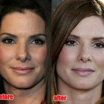 Sandra Bullock before and after pictures 150x150
