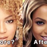 Beyonce nose job before and after 150x150