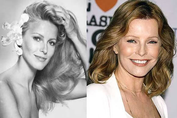 Cheryl Ladd before and after plastic surgery