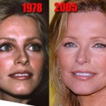 Cheryl Ladd plastic surgery before and after 150x150