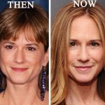 Holly Hunter before and after plastic surgery 150x150