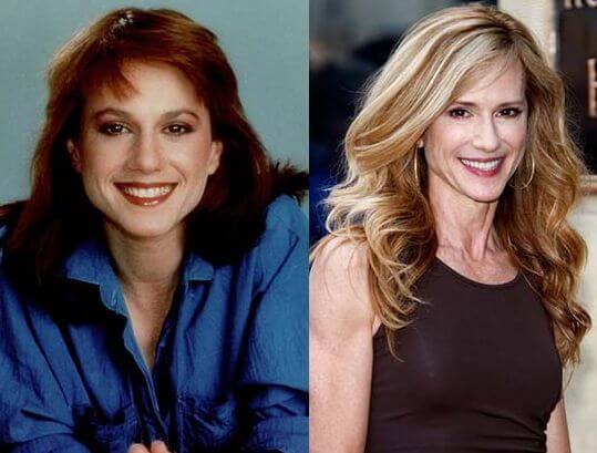 Holly Hunter plastic surgery before and after