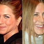 Jennifer Aniston nose job surgery 150x150