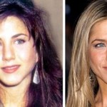 Jennifer Aniston plastic surgery before after 150x150
