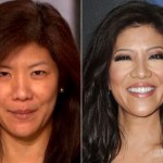 Julie Chen before and after surgery 150x150