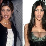 Kourtney Kardashian plastic surgery before after 150x150