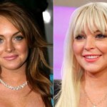 Lindsay Lohan before and after plastic surgery 150x150