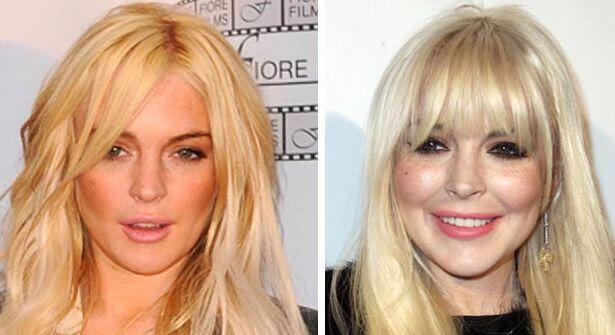 Lindsay Lohan plastic surgery before after