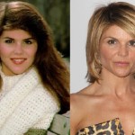 Lori Loughlin before and after plastic surgery 150x150