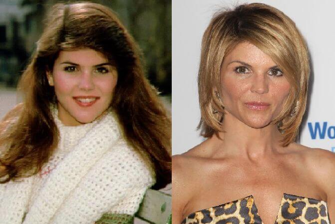Lori Loughlin before and after plastic surgery