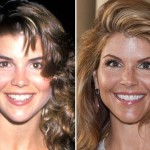 Lori Loughlin plastic surgery before and after 150x150