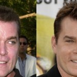 Ray Liotta before and after plastic surgery 150x150