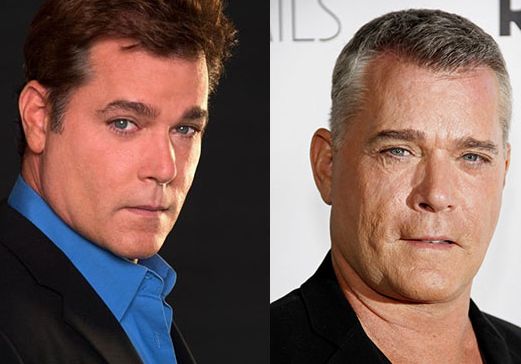 Ray Liotta plastic surgery before after