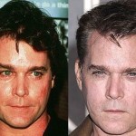 Ray Liotta plastic surgery before and after 150x150