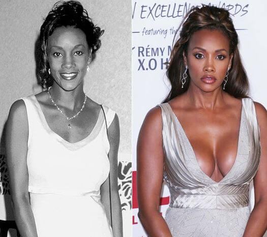 Vivica Fox plastic surgery before and after