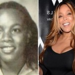 Wendy Williams before plastic surgery 150x150