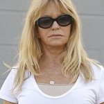 Goldie Hawn after lip implants 150x150