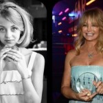 Goldie Hawn before and after facelift and cheek implants 150x150