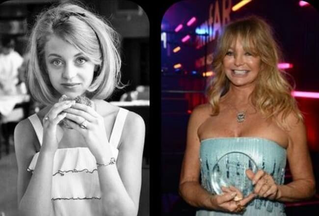 Goldie Hawn before and after facelift and cheek implants