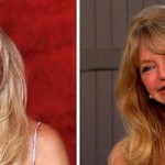 Goldie Hawn plastic surgery 2002 2012 150x150